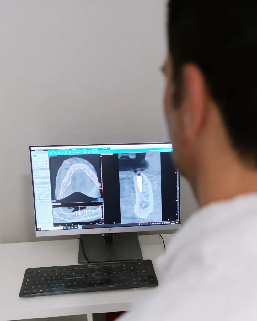 6387