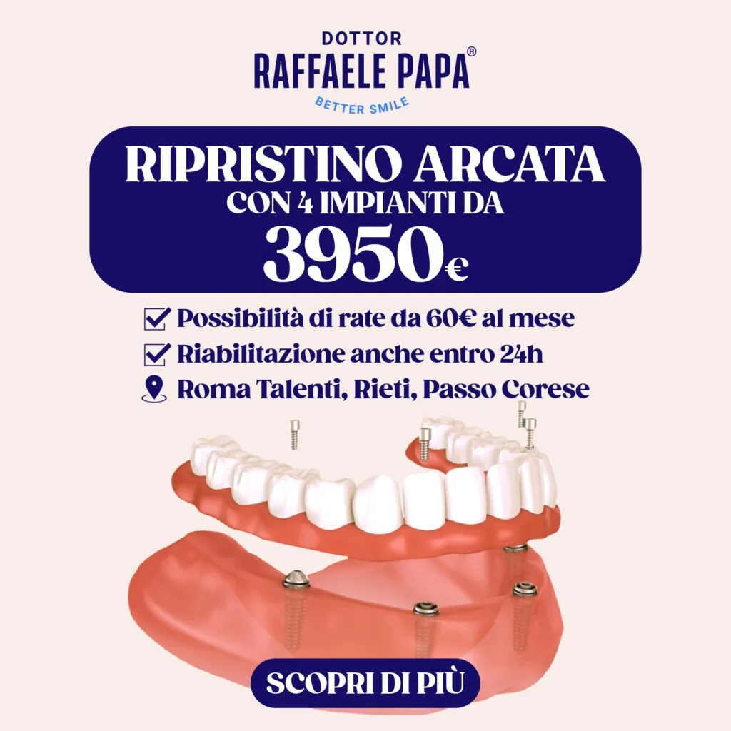 Quadrato Arcata 3950E 1